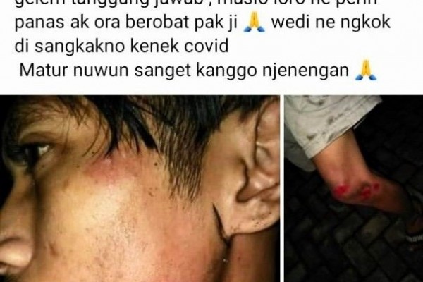 Unggah Info Hoaks Soal PPKM Malang, Pemuda Ini Diciduk Polisi