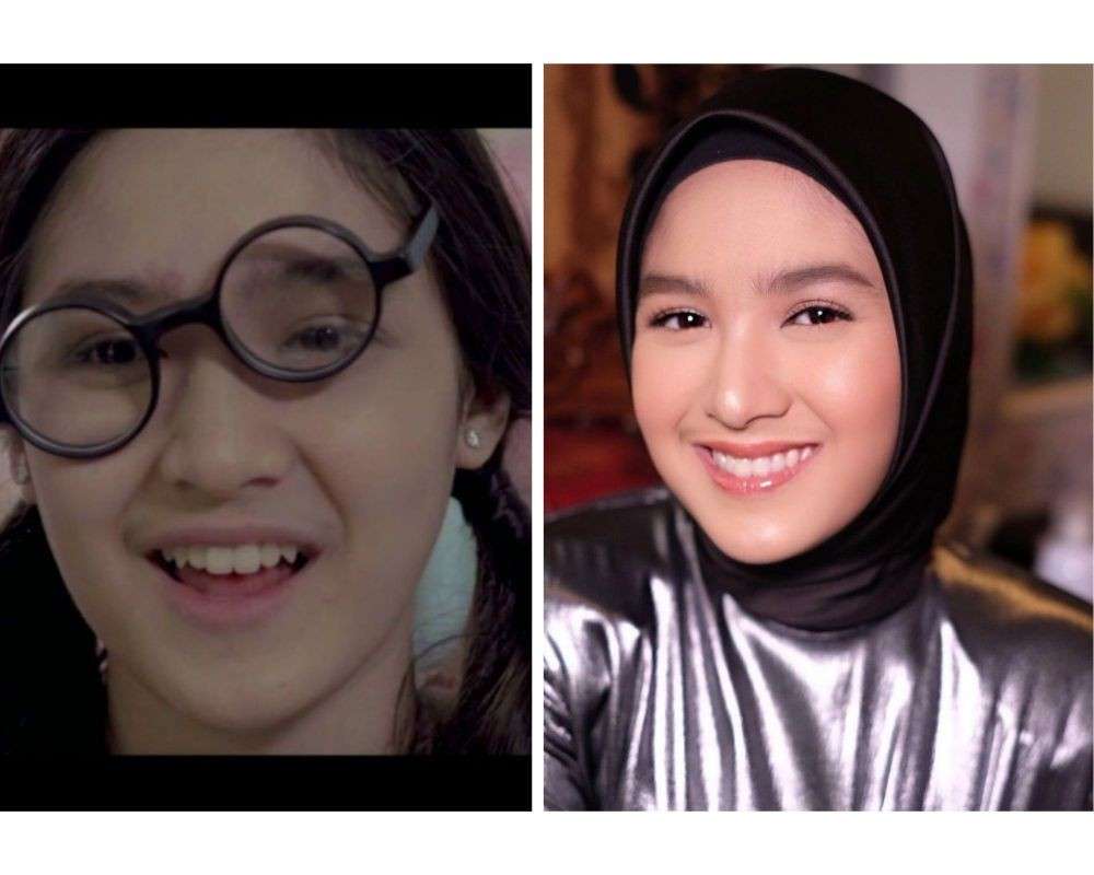 11 Artis Yang Memerankan Tokoh Culun Di Sinetron Dan Film