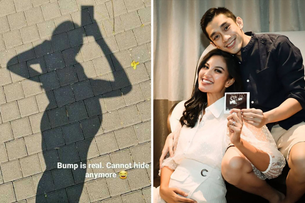 Umumkan Kehamilan, 10 Potret Zivanna Letisha Mengandung Bayi Kembar