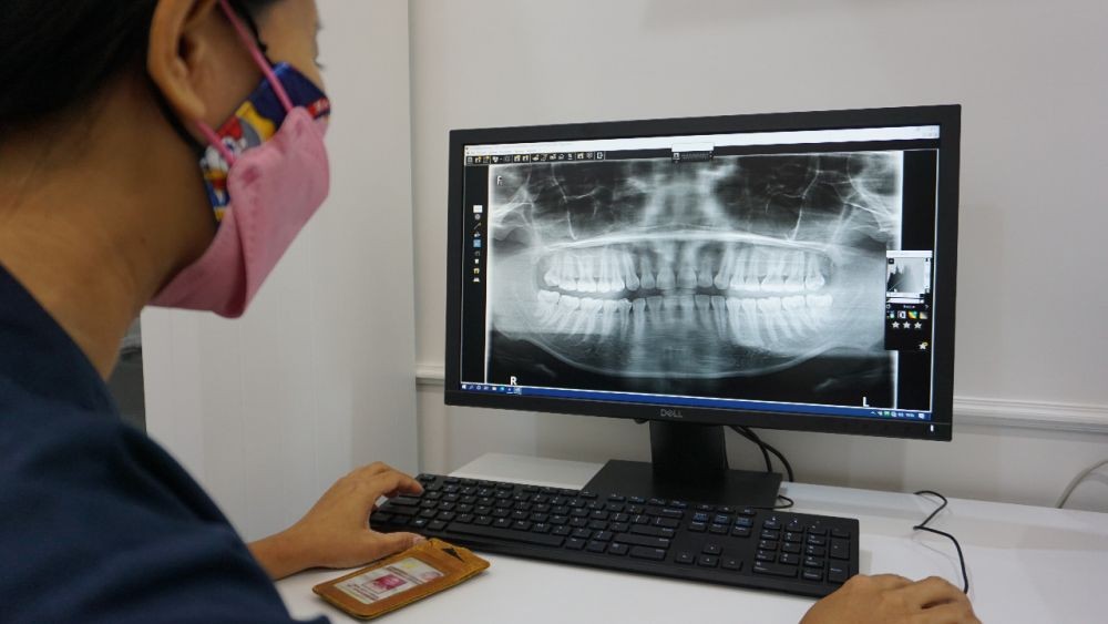 RSUP Sanglah Punya Alat Radiografi Tercanggih di Bali, Ini Faktanya