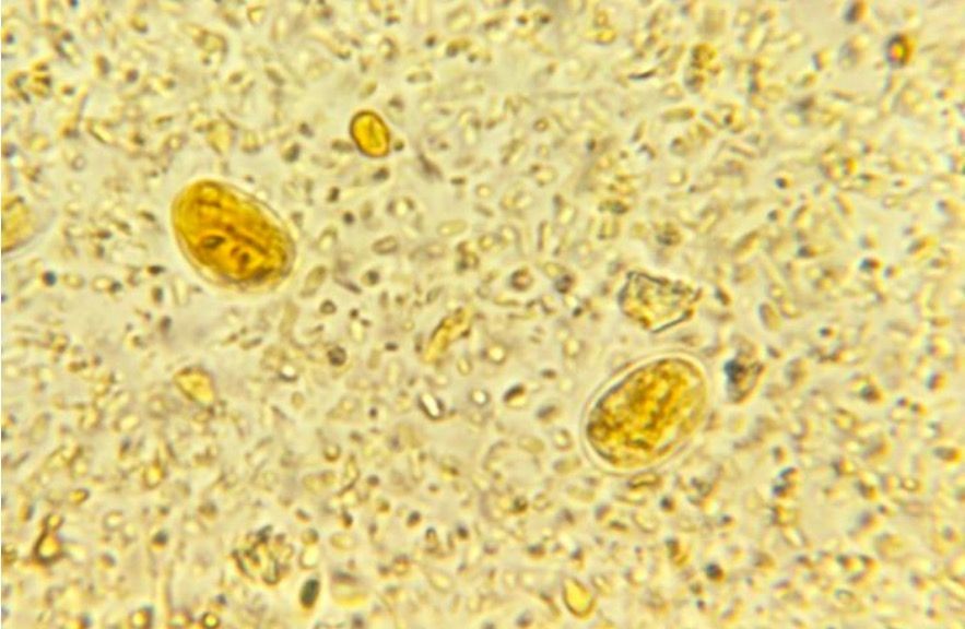 Mengenal Giardia lamblia, Parasit yang  Menginfeksi Sistem Pencernaan