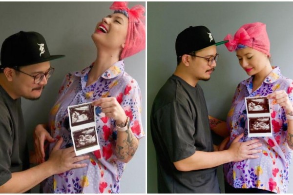 10 Potret Perjalanan Kehamilan Istri Derby Romero, Claudia Adinda