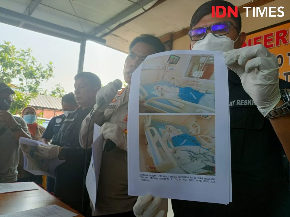 Gak Mau Ngasih Uang Palak, Pedagang Sosis di Tangerang Dibakar