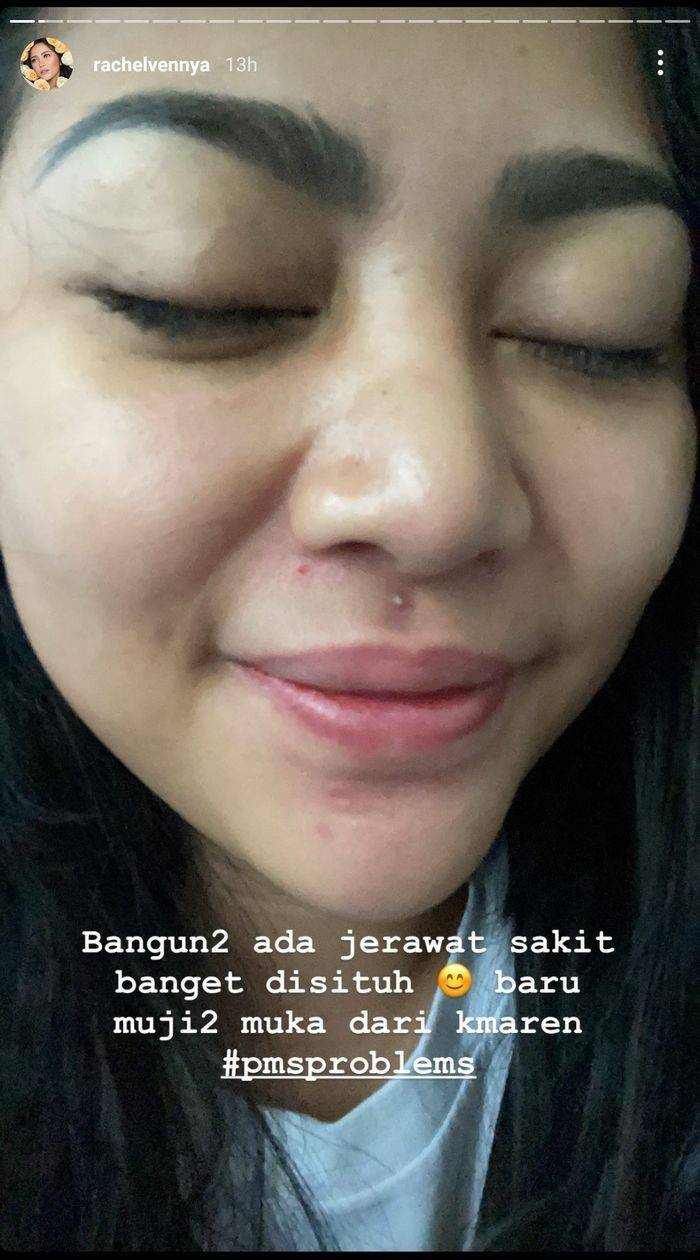 10 Potret Rachel Vennya Tampil Natural Yang Jadi Sorotan