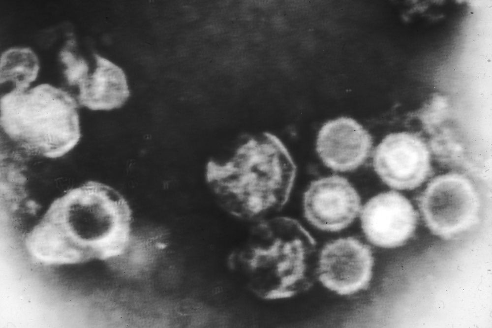 7 Infeksi Virus yang Bisa Menyebabkan Kanker, Waspada!