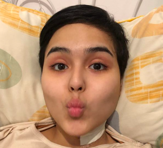 10 Potret Laura Anna Sempat Lumpuh Hingga Meninggal Dunia