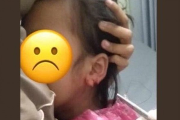 Sadis! Jambret Anting hingga Korban di Lombok Telinganya Sobek