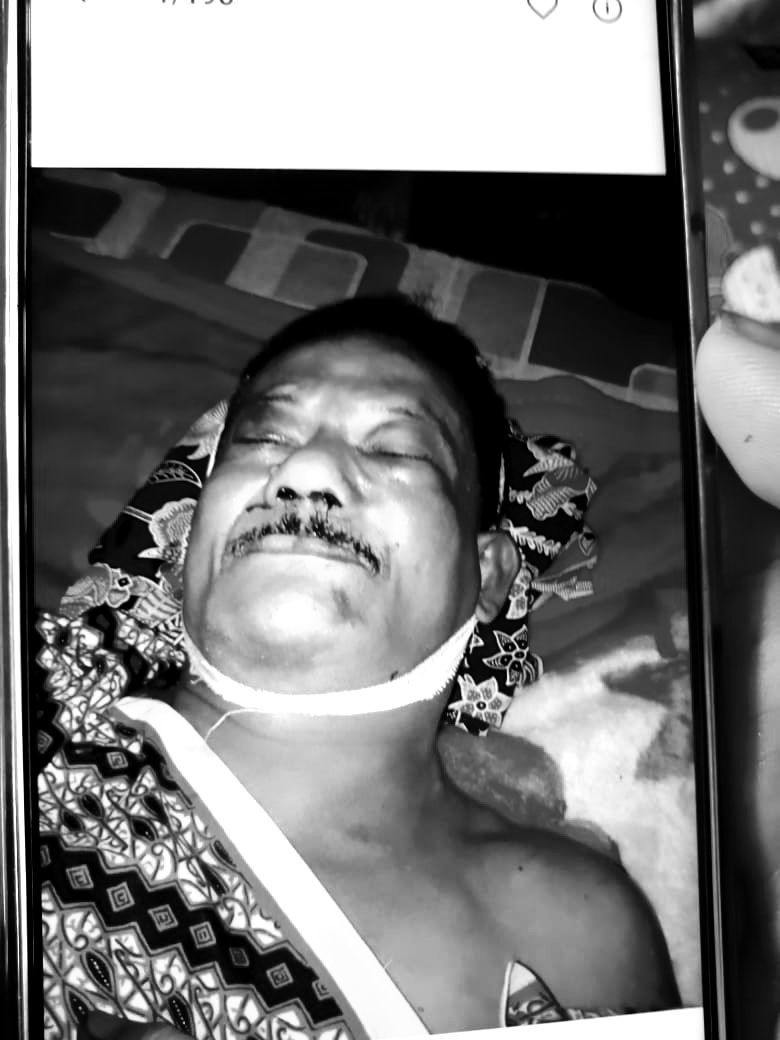 Menilik Kasus Tewasnya Kakek 60 Tahun oleh Oknum Polisi di Kalsel