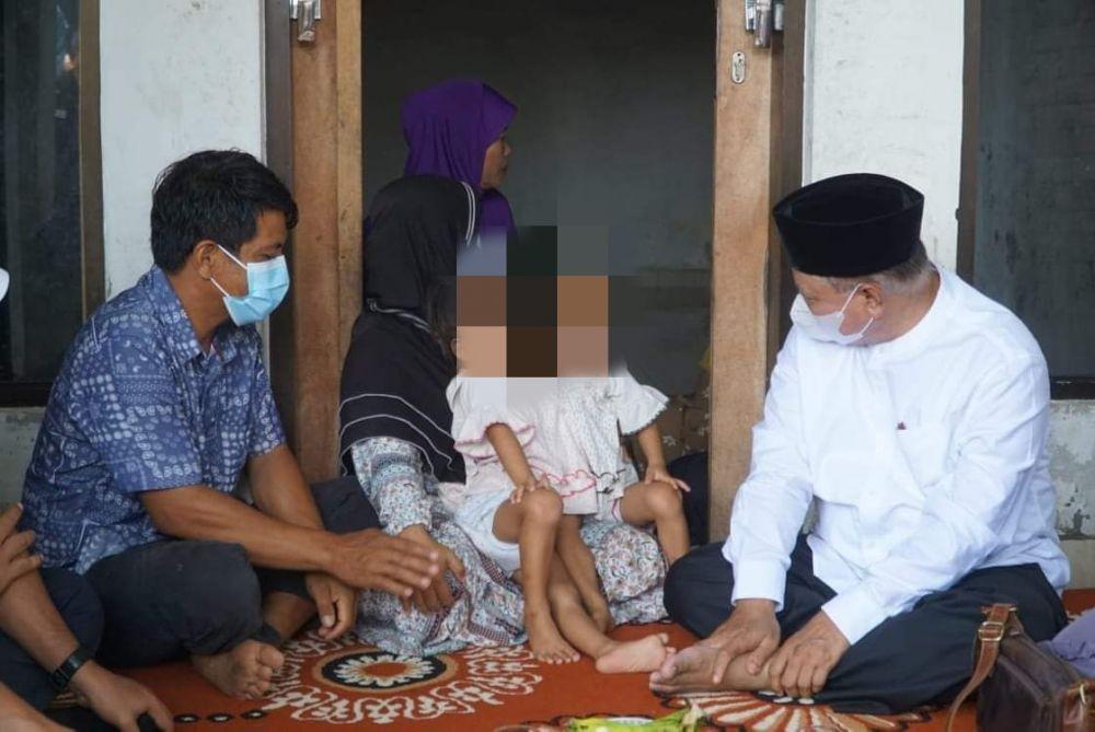 Kabar Gembira! Operasi Bayi Kembar Siam Anaya dan Inaya Berhasil