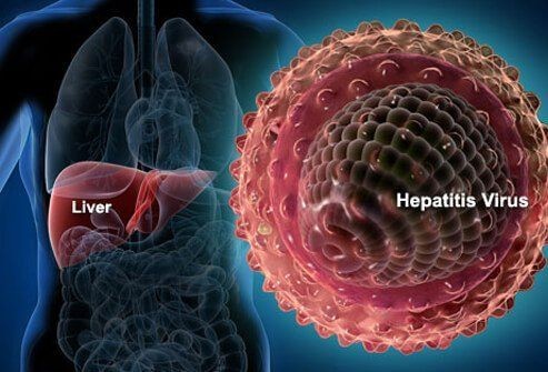 Kasus Suspek Hepatitis Misterius Ditemukan di Sumatra Barat 
