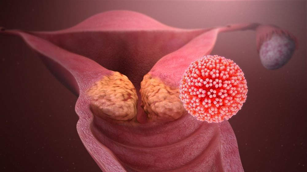 Mengenal Vaksin HPV, Penting untuk Mencegah Kanker Serviks