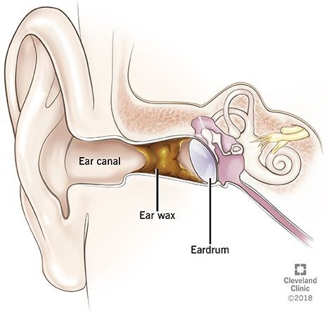 7 Masalah Telinga yang Sering Dialami Banyak Orang