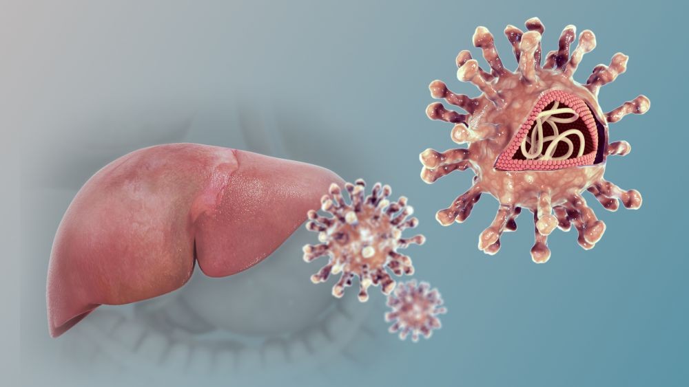 Bukan Akut Misterius, 3 Warga Sidoarjo Terkonfirmasi Hepatitis Tipe A