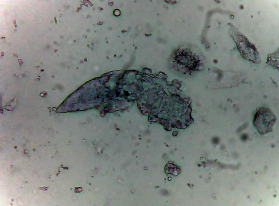 Яйца демодекса под микроскопом фото