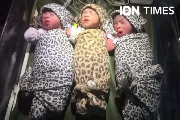 Pasutri di Muba Lahirkan Bayi Kembar 3 dengan Selamat