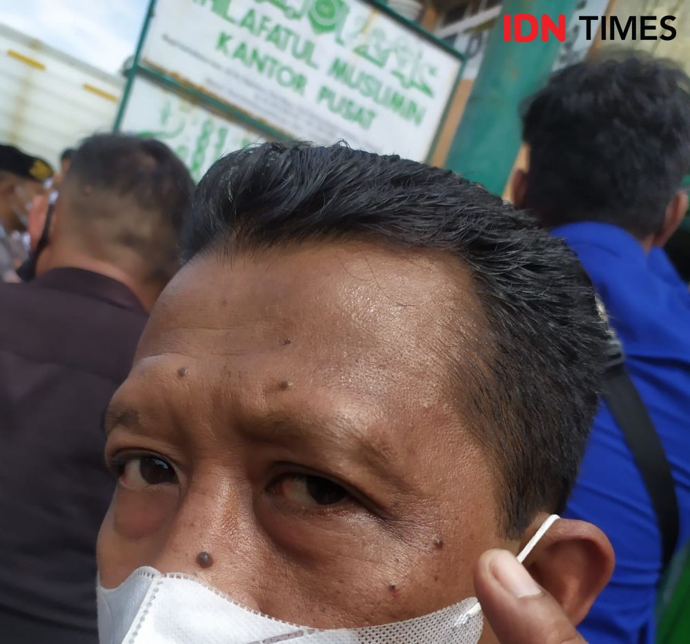 2 Jurnalis Lampung jadi Korban Kericuhan di Kantor Khilafatul Muslimin