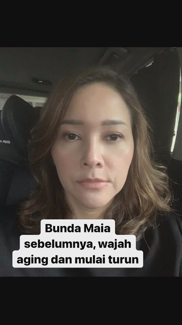 10 Potret Maia Estianty Lakukan Laser Botox