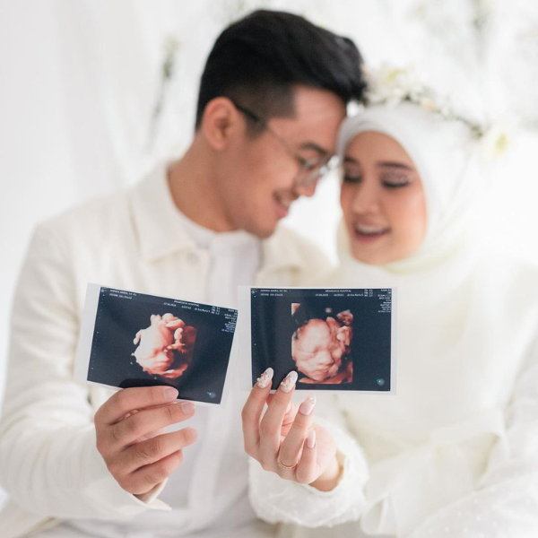 [QUIZ] Pilih Foto Maternity, Kami Tebak Jumlah Anakmu di Masa Depan