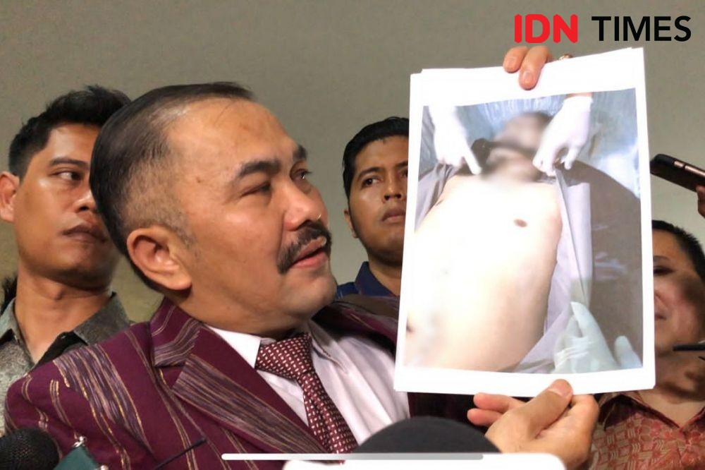 Kematian Brigadir J, Massa di Medan Desak Tangkap Irjen Ferdy Sambo