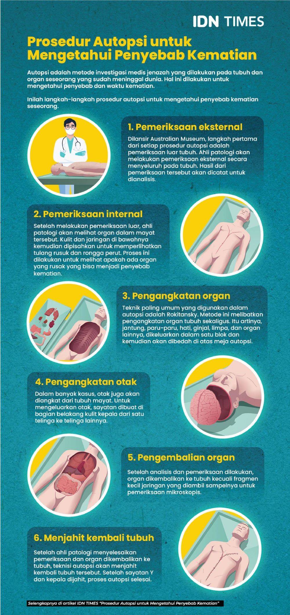 Prosedur Autopsi Untuk Mengetahui Penyebab Kematian