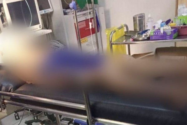 Nenek di Klungkung Meninggal Jadi Korban Tabrak Lari