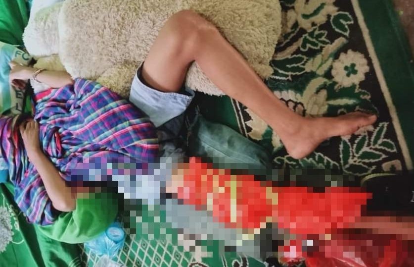Seorang Siswa di Bima Dipukul oleh Guru hingga Lututnya Retak