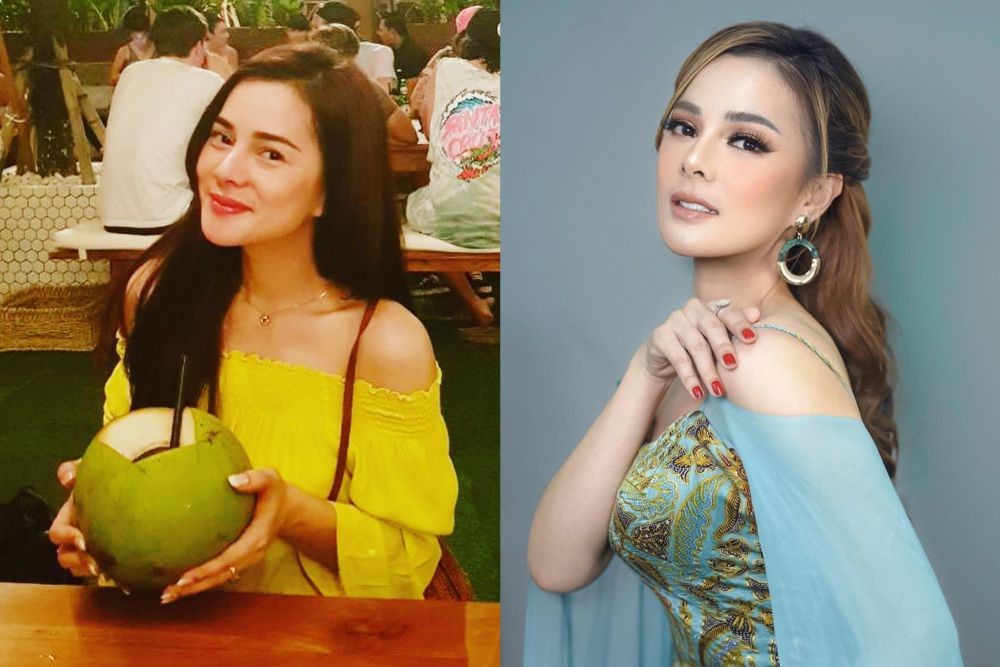 10 Potret Dulu Vs Kini Artis Yang Menikah Dengan Dokter