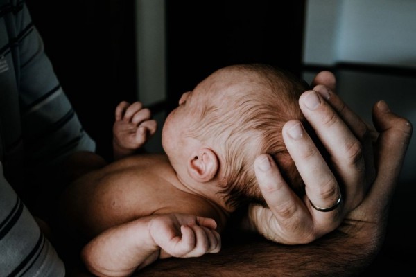 Plagiocephaly: Gejala, Penyebab, Diagnosis, Pengobatan