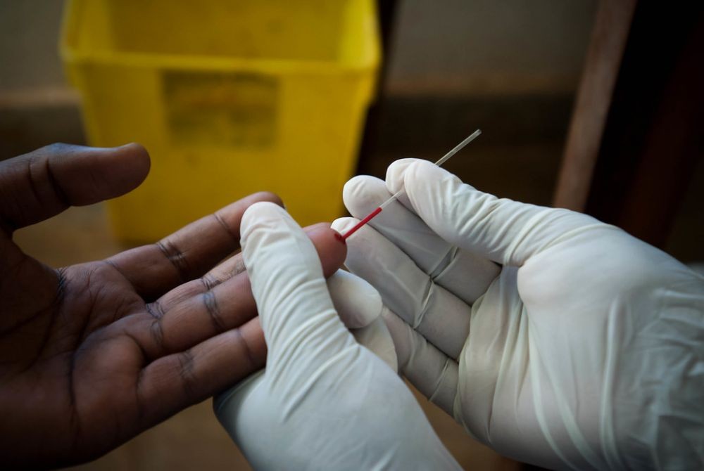Survei Kelompok Risiko Tinggi, 10 Pendatang di Bantul Positif HIV