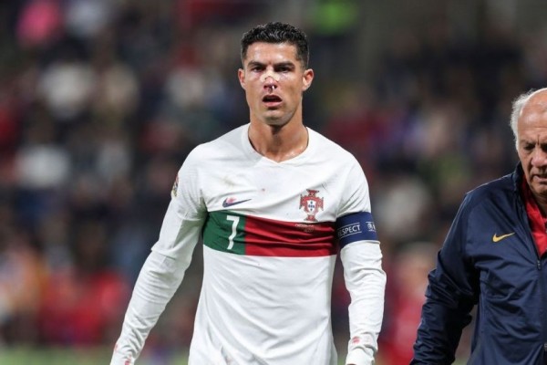 Cristiano Ronaldo Jadi Pesakitan: Babak Belur, Kasih Penalti ke Ceko