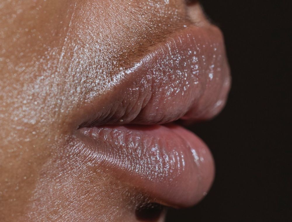 8 Penyebab Bibir Bengkak, dari Alergi hingga Kondisi Langka