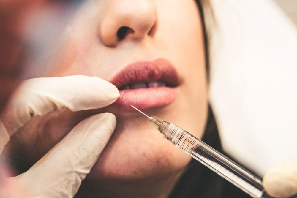 8 Penyebab Bibir Bengkak, dari Alergi hingga Kondisi Langka