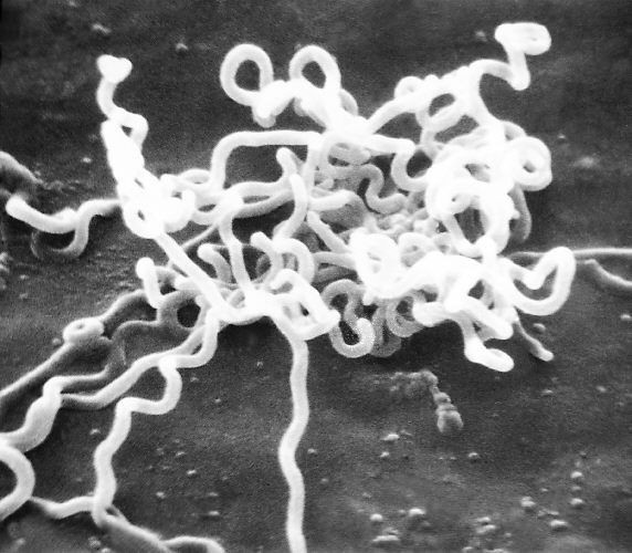 Banten Daerah Peringkat ke-6 Terbanyak Kasus Sifilis