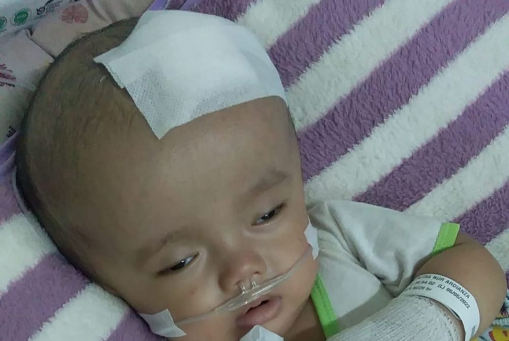 Bayi di Lamongan Menderita Hidrosefalus, Orangtua Berharap Keajaiban
