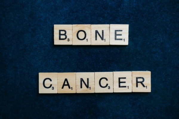 Osteosarcoma: Penyebab, Gejala, Diagnosis, Pengobatan