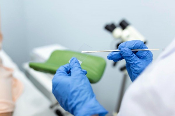 Pernah Dengar Pap Smear Anal? Ini Kegunaannya!