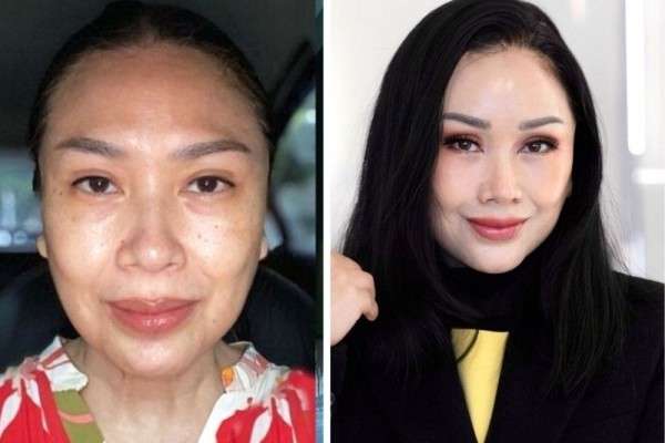 Potret Titi Dj Pamer Wajah Usai Oplas Netizen Pangling