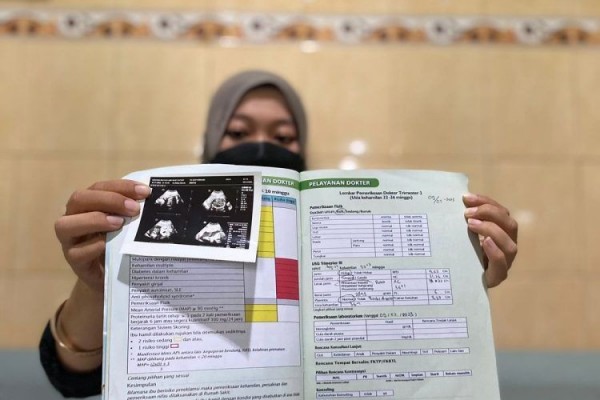 Puskesmas Punya Alat USG, Lebih Cepat Deteksi Kelainan Janin