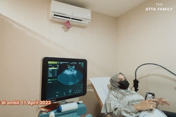 8 Potret Aurel USG Perdana Kehamilan Anak Kedua, Masih Gak Nyangka