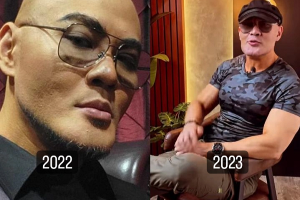 7 Potret Terbaru Deddy Corbuzier, Dagunya Dianggap Beda