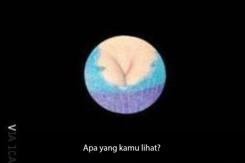 [QUIZ] Buktikan Otak Kamu Gak Ngeres Lewat Foto Ambigu yang Di-crop Ini