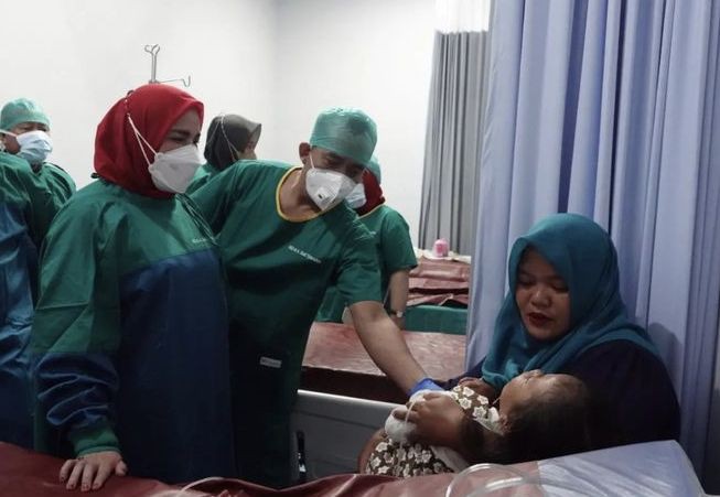 HUT Kota Bandar Lampung, 34 Pasien Bibir Sumbing Operasi Gratis