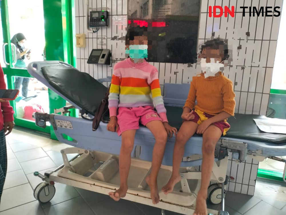 2 Anak di Surabaya Digigit Monyet, Demam Lalu Dirujuk ke RS