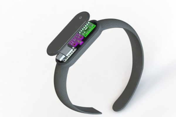 Mahasiswa UNAIR Bikin Smartwatch Pendeteksi Diabetes
