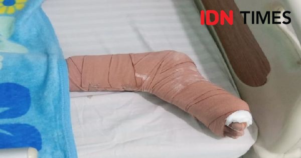 Niat Renang dan Rekreasi, Kaki Remaja Luka Kena Keramik Kolam Renang