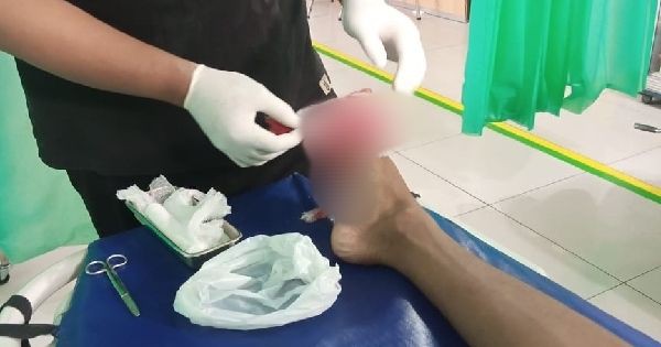 Niat Renang dan Rekreasi, Kaki Remaja Luka Kena Keramik Kolam Renang