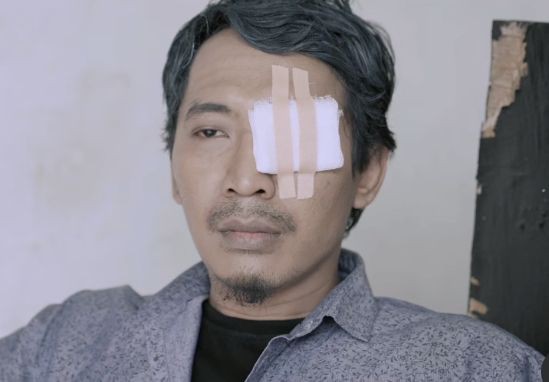 Hari Penglihatan se-Dunia, Ini 10 Rumah Sakit Mata di Kota Medan