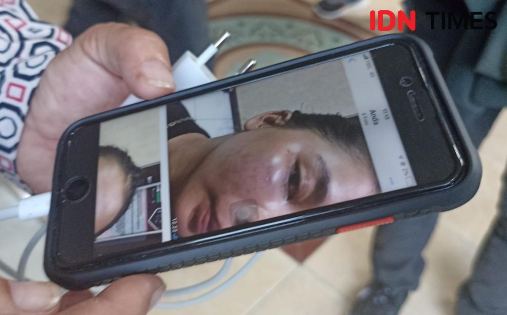 Polisi di Makassar Diduga Pukuli Mantan Pacar, Wajah Korban Lebam
