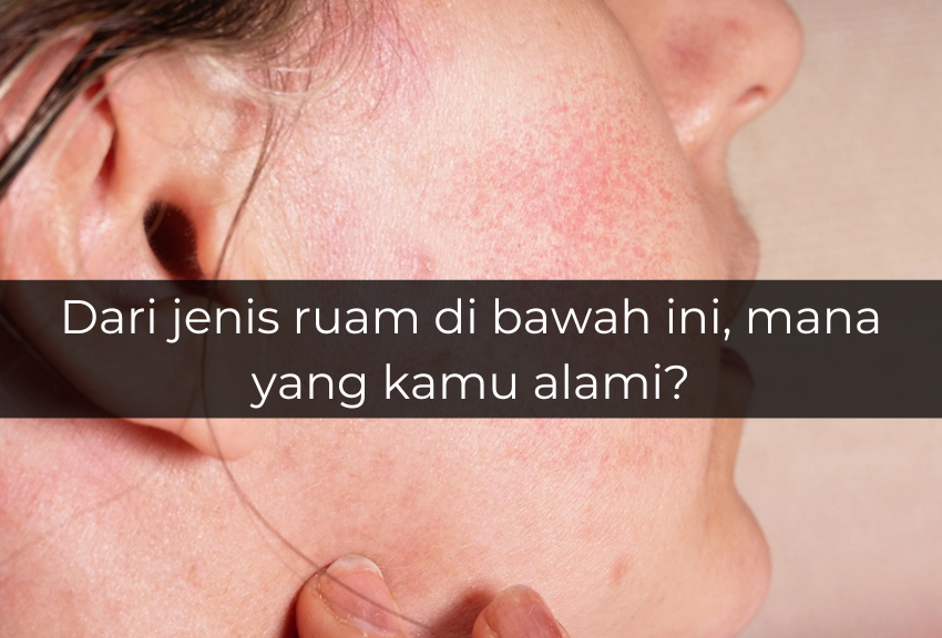 [QUIZ] Dari Jenis Ruam yang Kamu Alami, Ini Penyakit yang Harus Kamu Waspadai