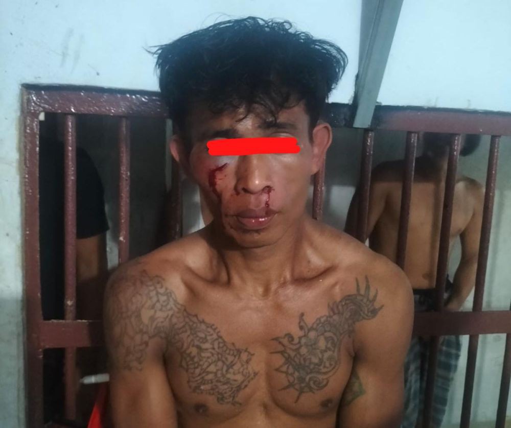 Ditolak Rujuk, Pria di Makassar Sirami Mantan Istri Air Keras